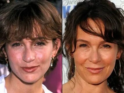 Jennifer Grey before and after plastic surgery Celebrity pla