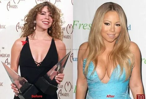 Mariah Carey Plastic Surgery: Done Modestly With Skill