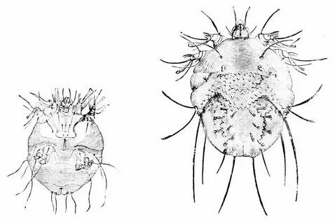 How to Get Rid of Scabies in 5 steps Sterifab Bed Bug Blog