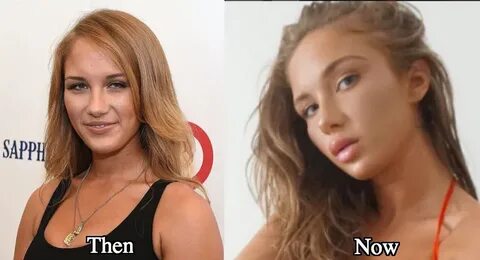 Niykee heaton plastic surgery - Plastic Surgery