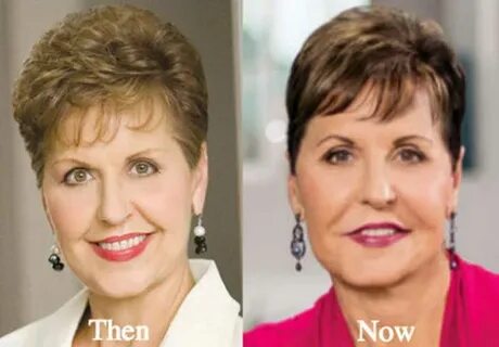 Joyce Meyer Before Plastic Surgery mmhstonedesign