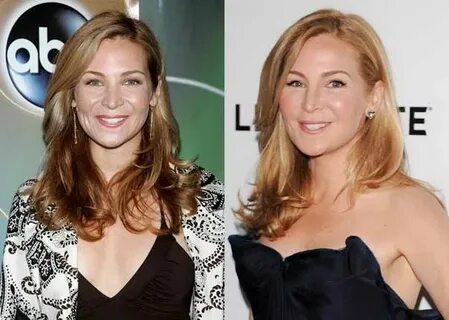 Jennifer Westfeldt before and after plastic surgery scandals