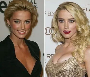 Amber Heard Plastic Surgery - Celebrities plastic surgery