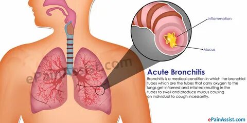 Acute bronchitis boob hurts
