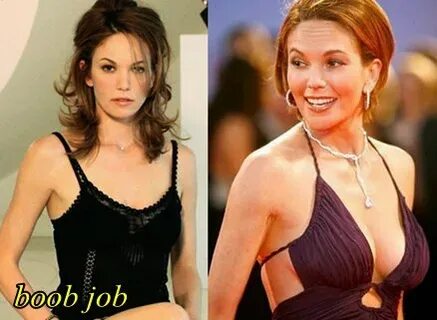 Diane Lane Plastic Surgery Before and After - Plastic Surger