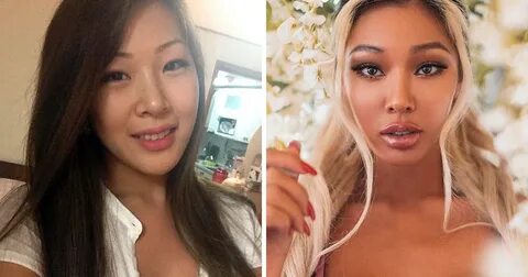 21 Korean Celebs Who Have Undergone Cosmetic Procedures Or S