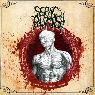 Decay in Buried Bodies Septic Autopsy слушать онлайн на Янде