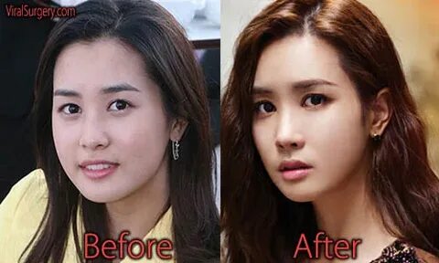 Lee Da Hae Plastic Surgery, Before and After Jaw Surgery Pic