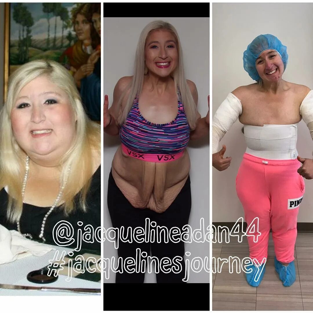 Jacqueline's Journey в Instagram: "Down over 350 pounds over the ...