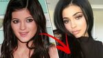 ► 10 Most EXPENSIVE Celebrity PLASTIC Surgeries ✓ - YouTube