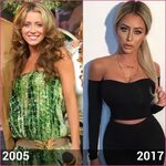 10 Shocking Pics of Celebrities Before And After Plastic Sur