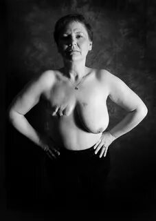 Women Bare Mastectomy Scars To Raise Breast Cancer Awareness