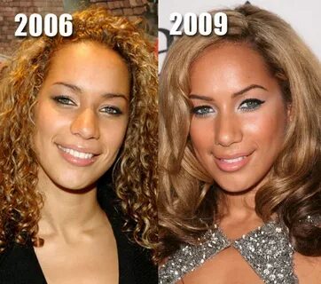 Leona Lewis Plastic Surgery: Nose Job Before and After Photo