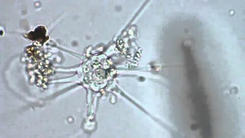 A Star Amoeba Seen On Nikon Fluophot Microscope - YouTube