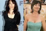 Katey Sagal Plastic Surgery - Plastic Industry In The World