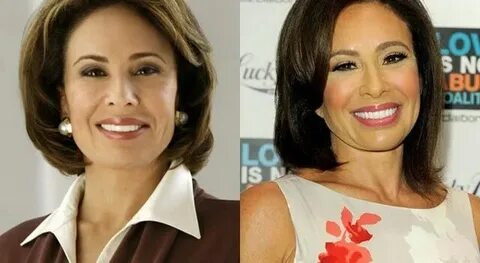 Jeanine Pirro plastic surgery - Define NetWorth