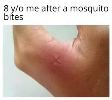 The amount of mosquito bites meme - AhSeeit