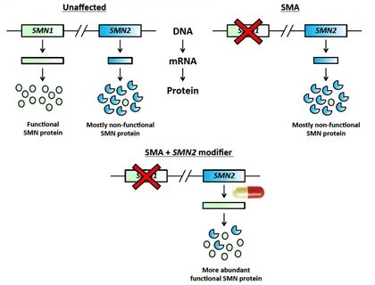 Spinal Muscular Atrophy UK