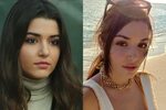 До и после: 9 известных турецких актрис, которые сделали пла