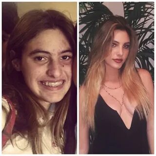 Lele Pons Puberty transformation Glo up, Before, after puber