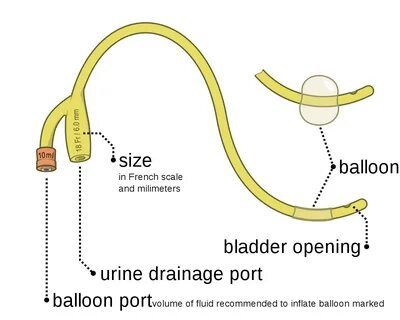 How To Flush A Catheter Tube - How to Guide 2022