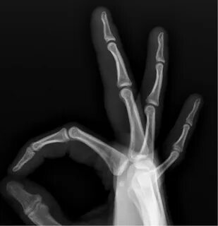 X-Rays - Joseph J. Schreiber, MD