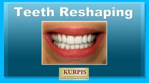 Teeth Reshaping - YouTube