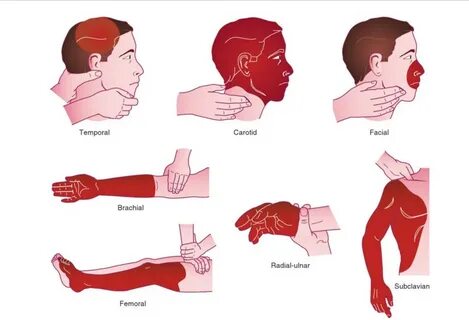Identifying and Using Pressure Points to Control Bleeding - 