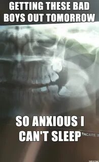 Help me Imgur. Tell me your own funny wisdom teeth removal s