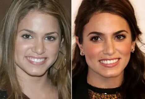 Nikki Reed Nose Job Nose job, Plastic surgery, Cosmetic surg