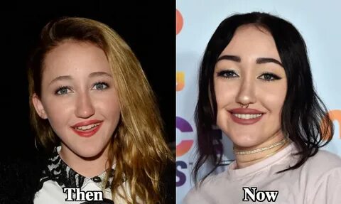 Noah Cyrus eyebrows lift before and after photos - Latest Pl