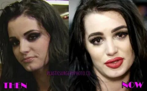 Paige WWE Plastic Surgery Before and After Photos Paige wwe,