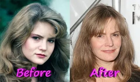 What You Need to Know About Jennifer Jason Leigh Plastic Sur