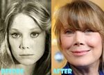 Sissy Spacek Plastic Surgery Before After Nose Job - Lovely 