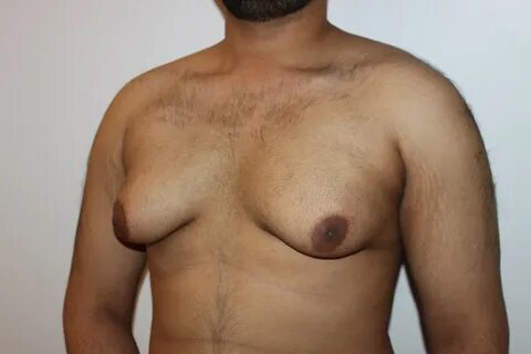 Man boobs to chest