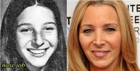 Lisa Kudrow Plastic Surgery Before and After Nose Job, Botox