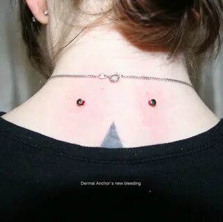 Neck After Surgery Funny Quotes. QuotesGram