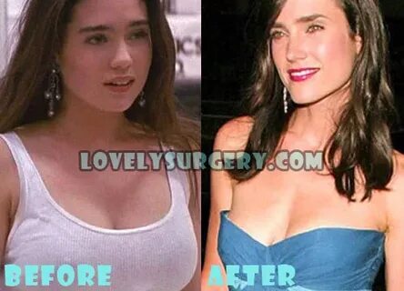 Jennifer Connelly Plastic Surgery Boob Job (Breast Reduction