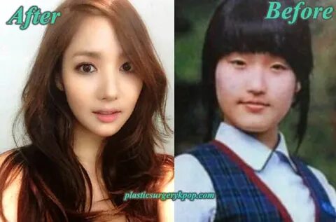 Park Min Young Plastic Surgery Before and After Pictures