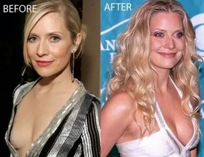 Emily Mallory Procter captivating look and plastic surgery