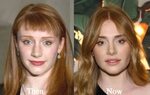 Bryce Dallas Howard Plastic Surgery Before and After Photos 