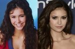 Nina Dobrev before and after plastic surgery Celebrity plast