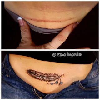 Татуировка на шраме от аппендицита (59 фото)