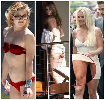 Mischa Barton Cellulite farewellcellulite