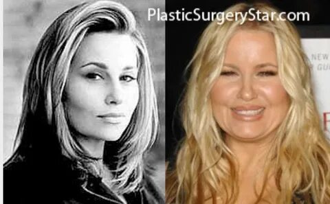 Jennifer Coolidge before and after plastic surgery. I don't 