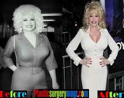 Dolly Parton Diet Before and After Plastic Surgery Magazine