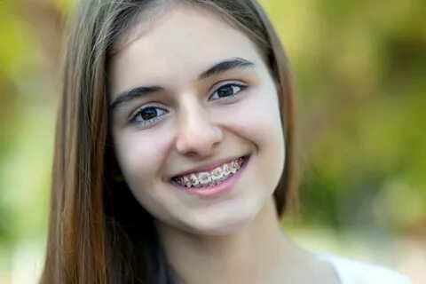 Braces: Your FAQ Answered - Regent Avenue Dental Centre