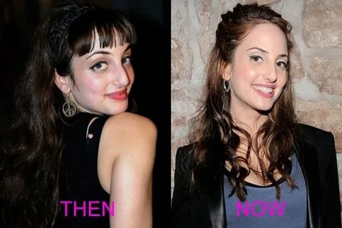 Alexa Ray Joel Plastic Surgery Gone Wrong Before and After