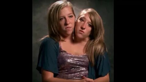 Famous Conjoined Twins - Abby And Brittany Hensel Are Now Te