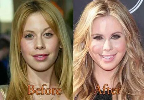 wolle Kritisieren Band t ara plastic surgery before and afte